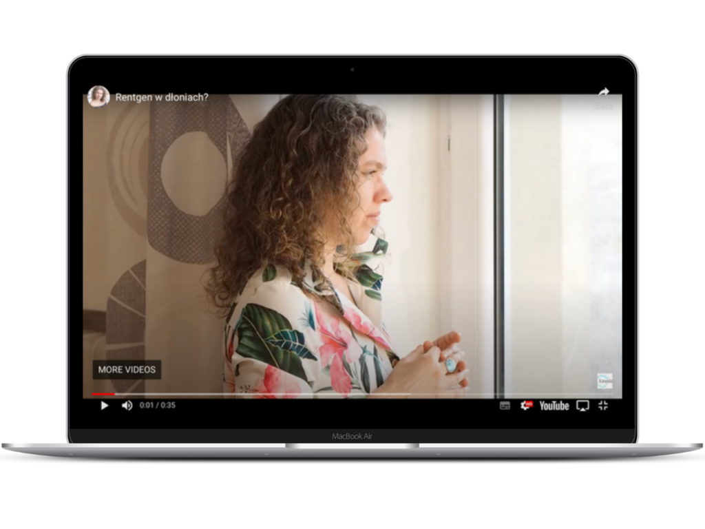 Read more about the article Videopamiętnik młodej masażystki-Rentgen w dłoniach?
