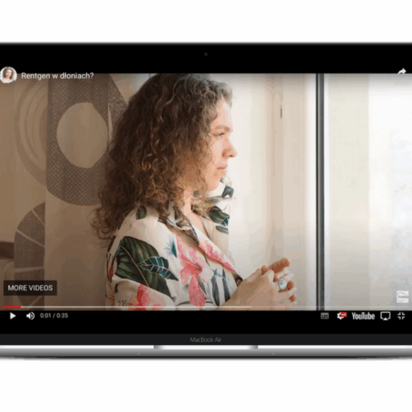 Videopamiętnik młodej masażystki-Rentgen w dłoniach?
