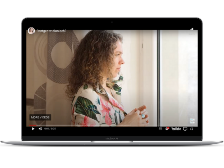 Read more about the article Videopamiętnik młodej masażystki-Rentgen w dłoniach?